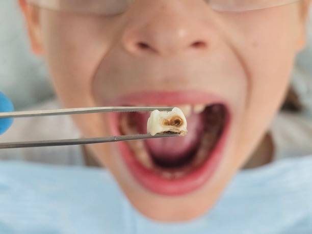 Best Cosmetic Emergency Dentistry in Sharpsburg, PA