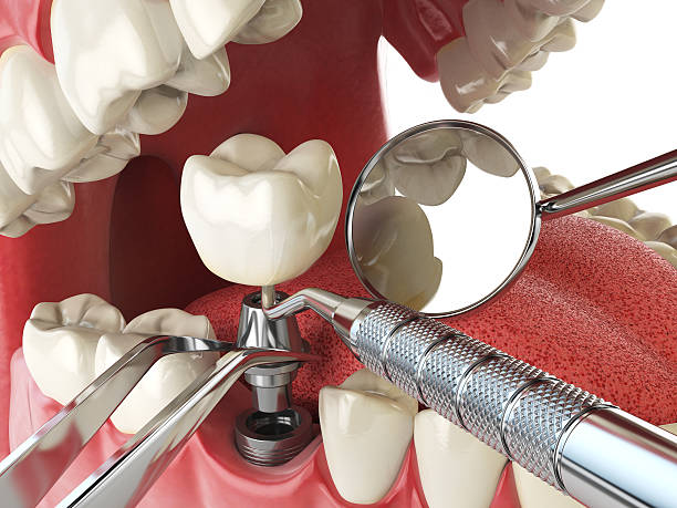 Best Emergency Gum Treatment in Sharpsburg, PA