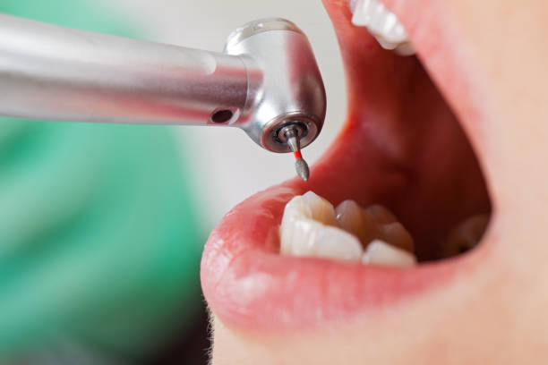 Best Emergency Treatment for Dental Infections or Abscesses in Sharpsburg, PA